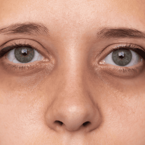 Tired & Dull Skin