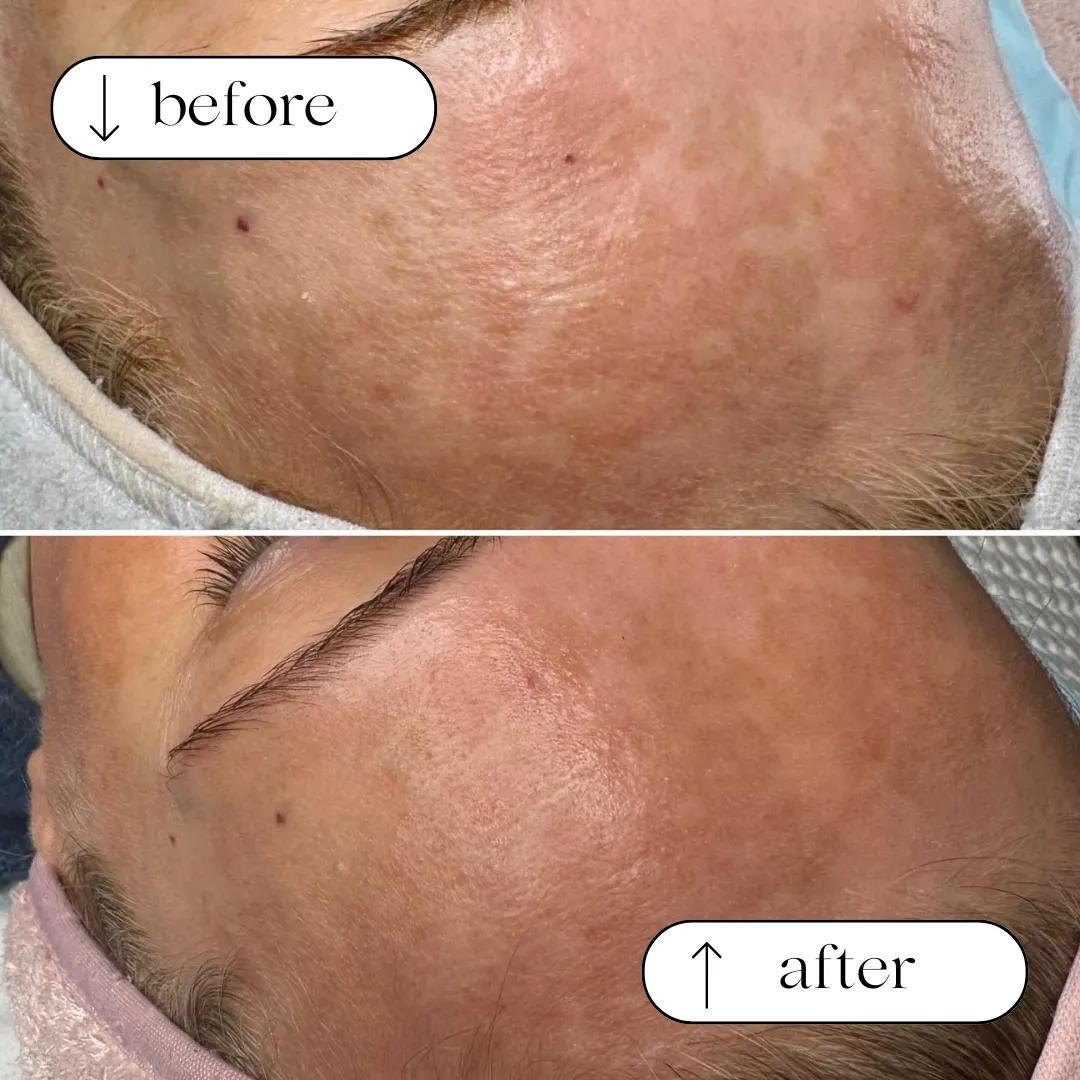 Before and after result 1