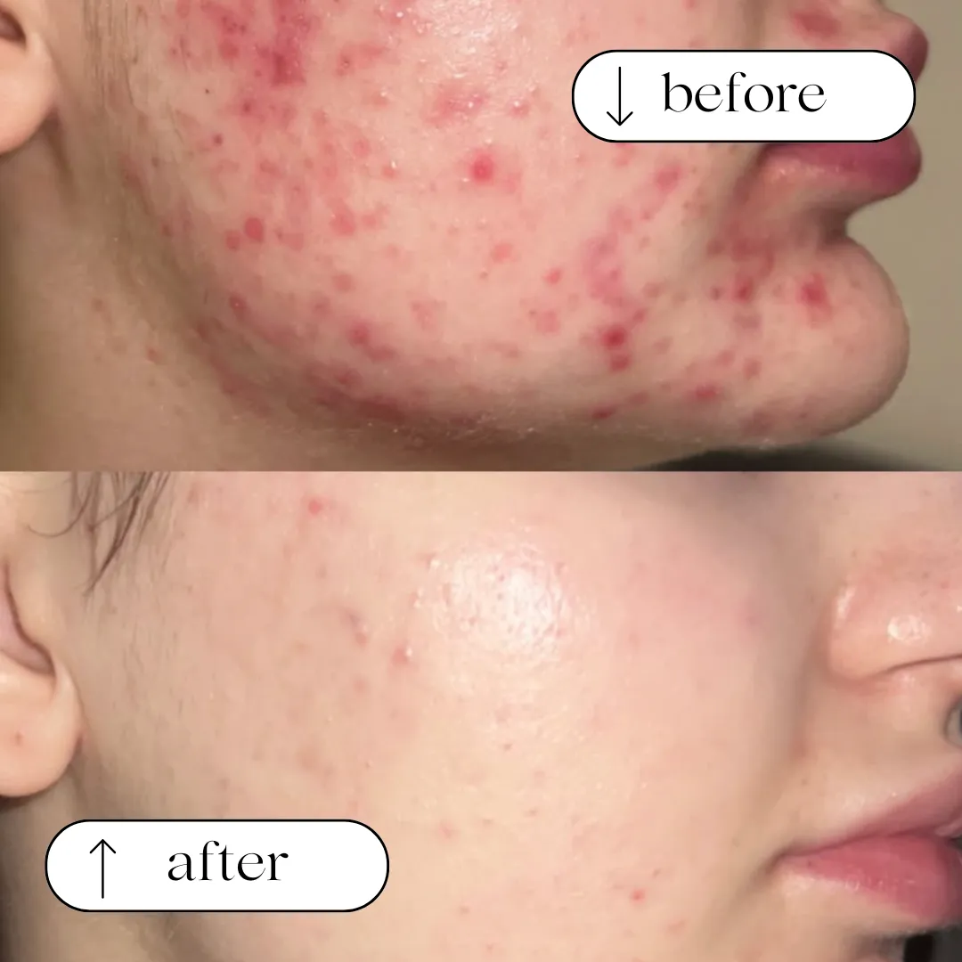 Before and after result 3