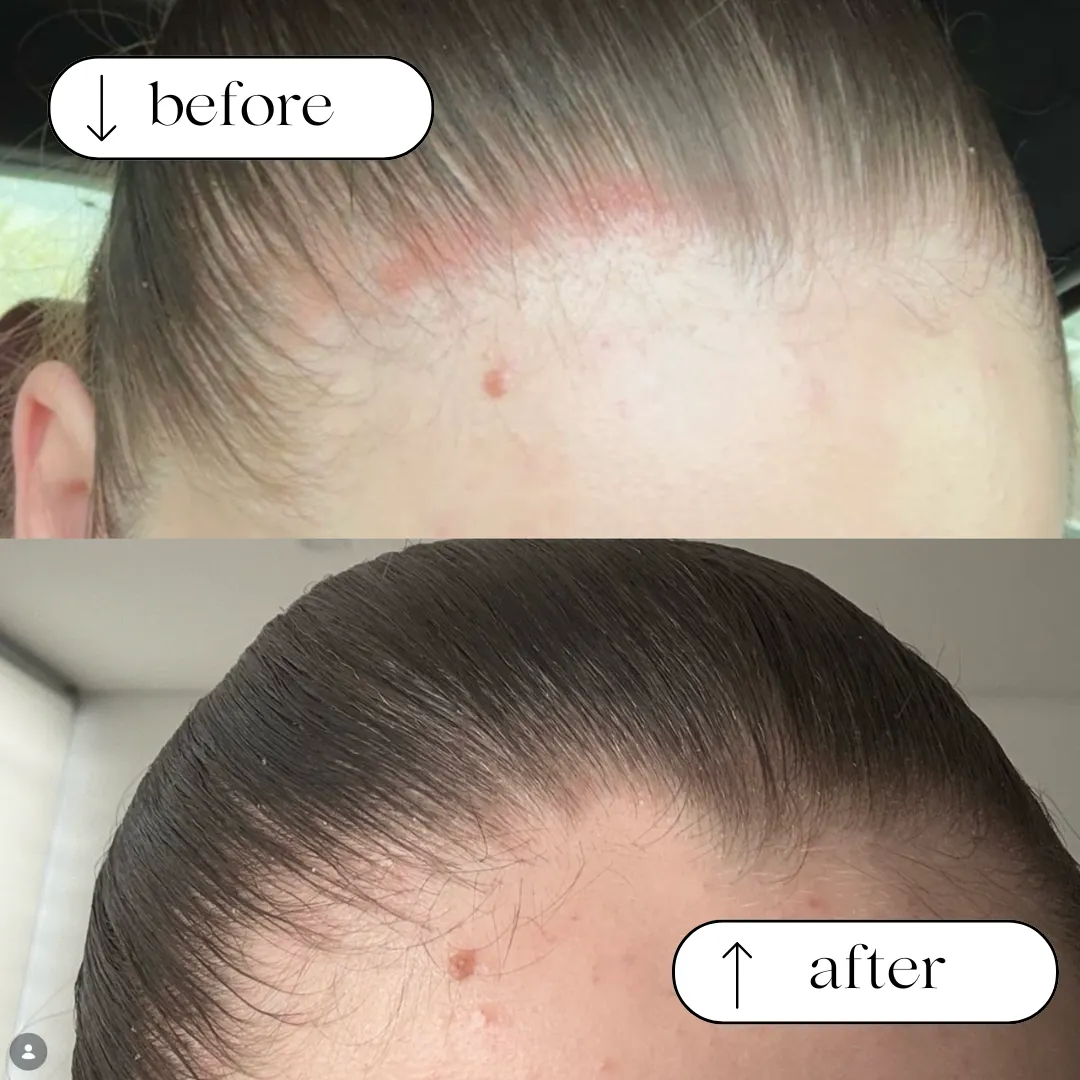 Before and after result 4