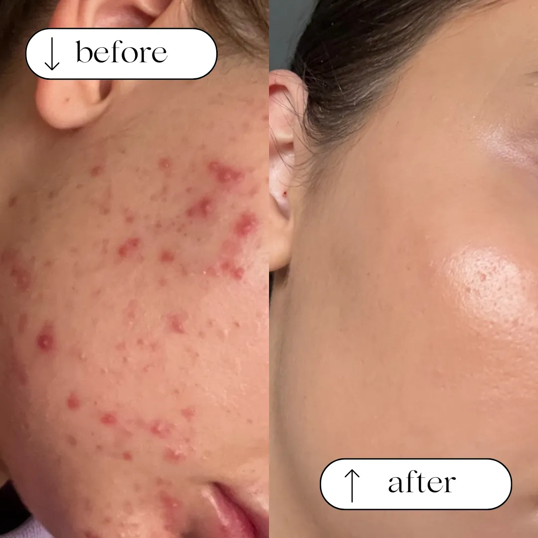 Before and after result 5
