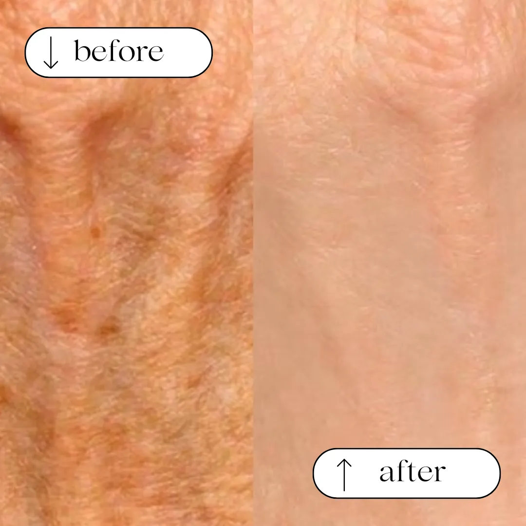 Before and after result 6